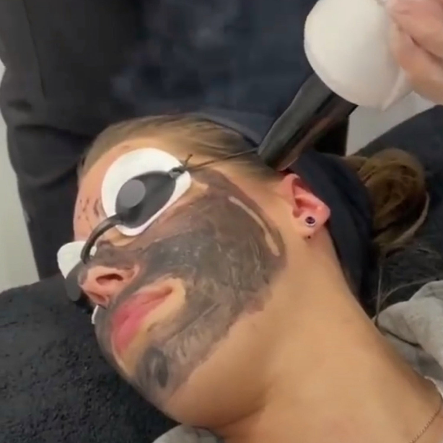Carbon Spectra Peel using modern equipment and technique at Rejuvenate Laser & Skin Clinic
