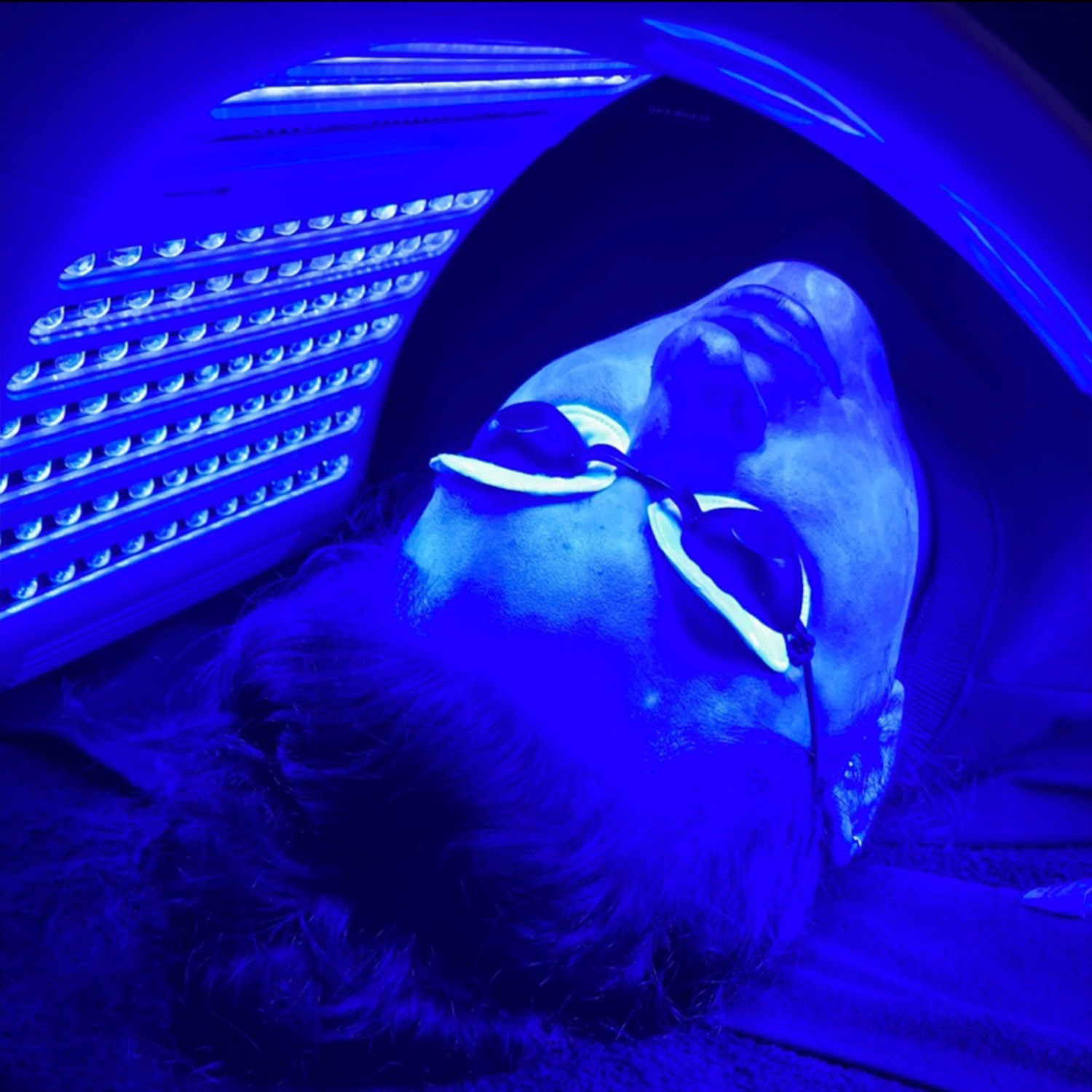 LED Light Therapy using modern equipment and technique at Rejuvenate Laser & Skin Clinic