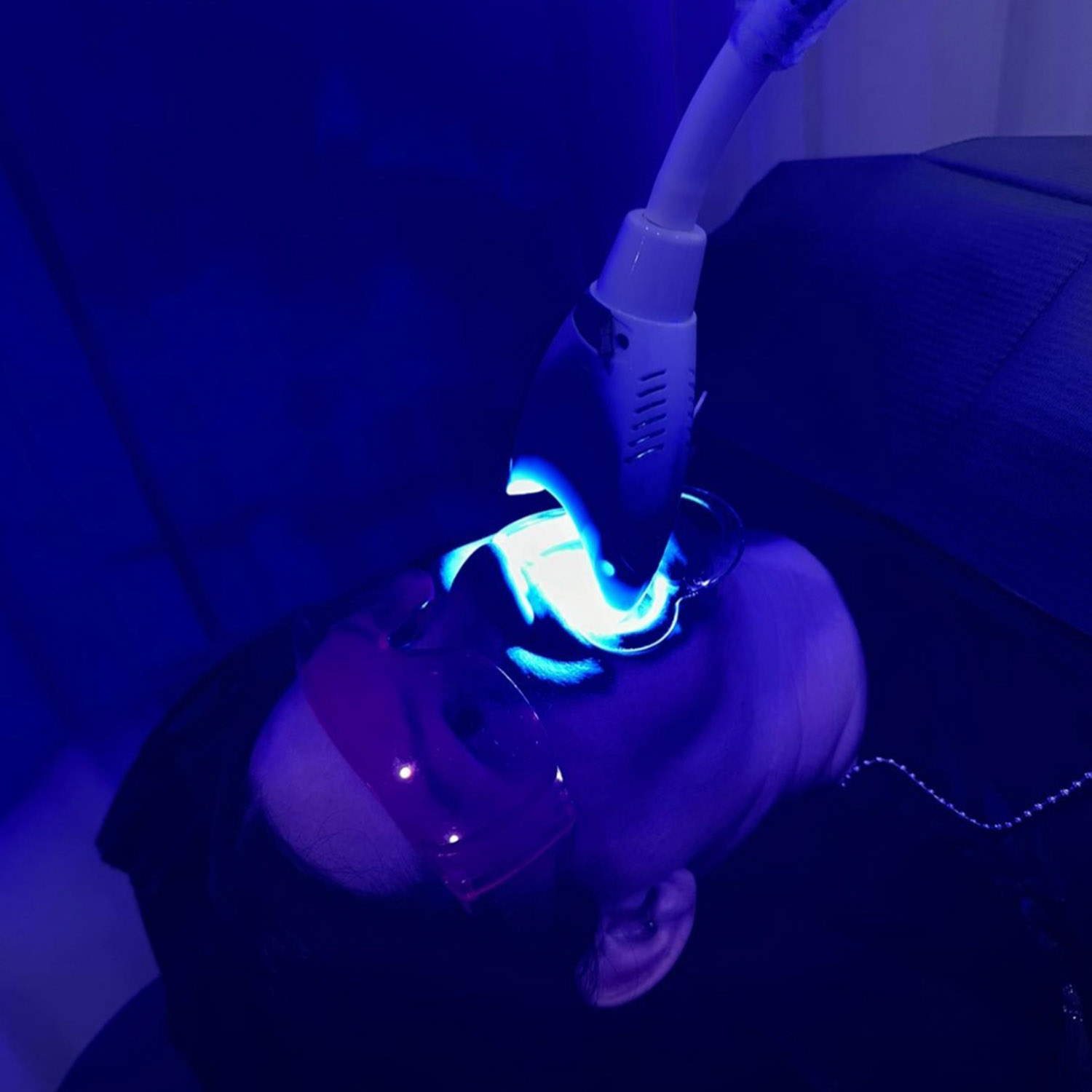 Teeth Whitening Treatment using modern equipment and technique at Rejuvenate Laser & Skin Clinic