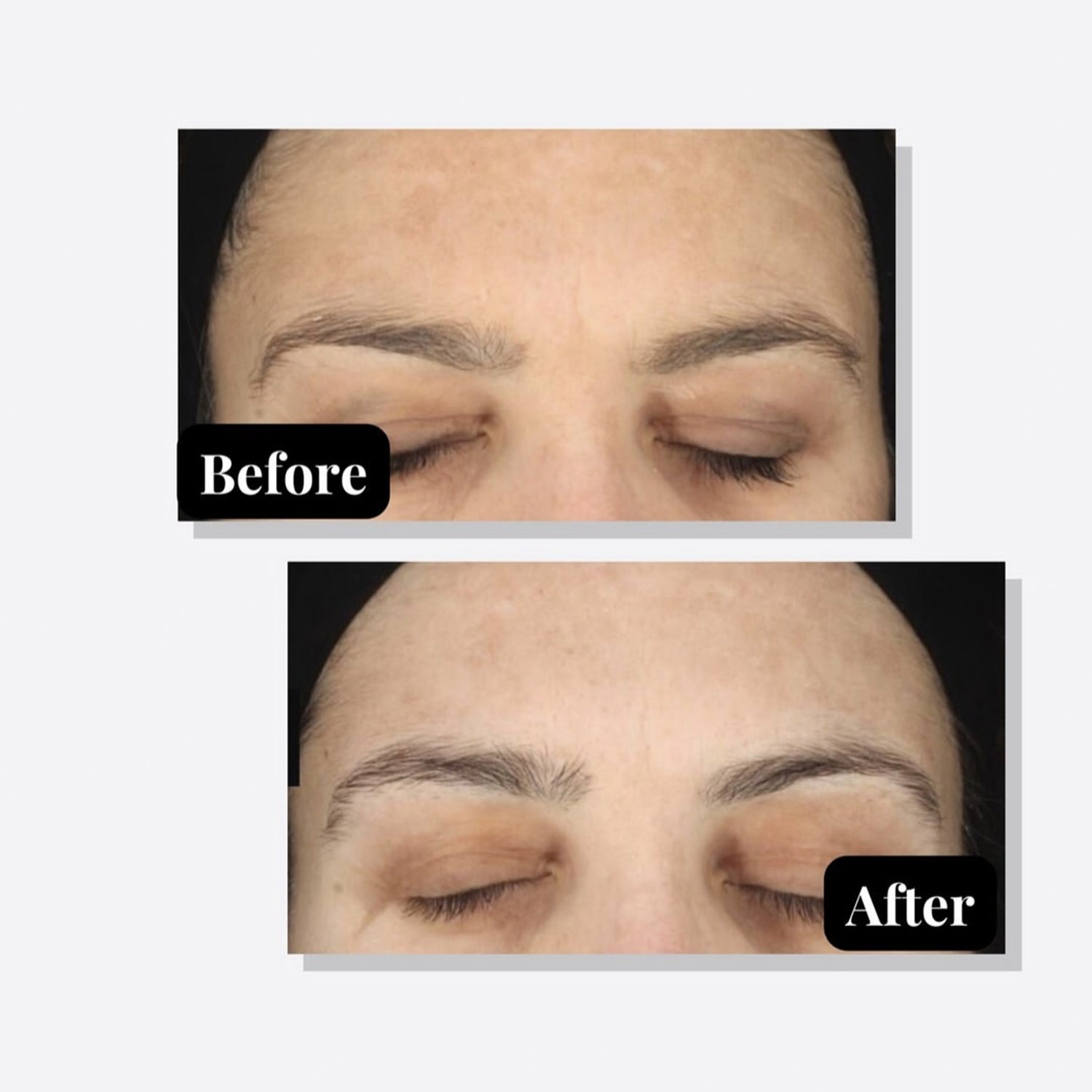 Age Element Treatment using modern product and technique at Rejuvenate Laser & Skin Clinic